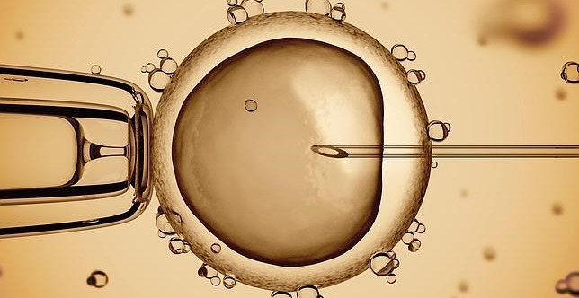 tecnica